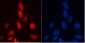 Anti-RENT1/hUPF1 Antibody Picoband™ (monoclonal, 11E7)